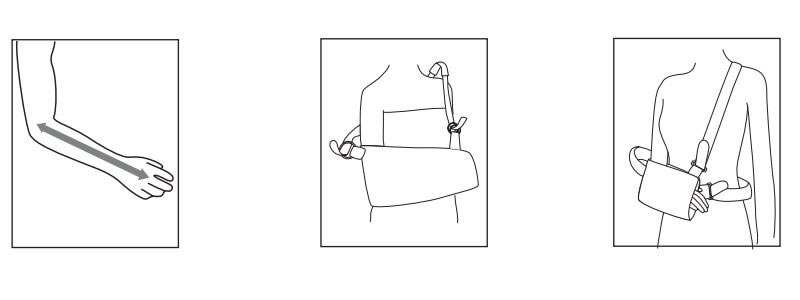 Arm Sling Instructions For Use
