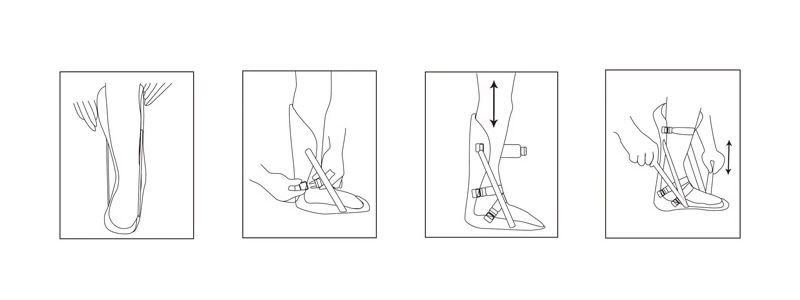 Night Splint For Plantar Fasciitis Instructions